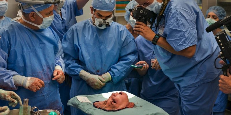 INCREDIBLE: youngest face transplant in the U.S. [video]