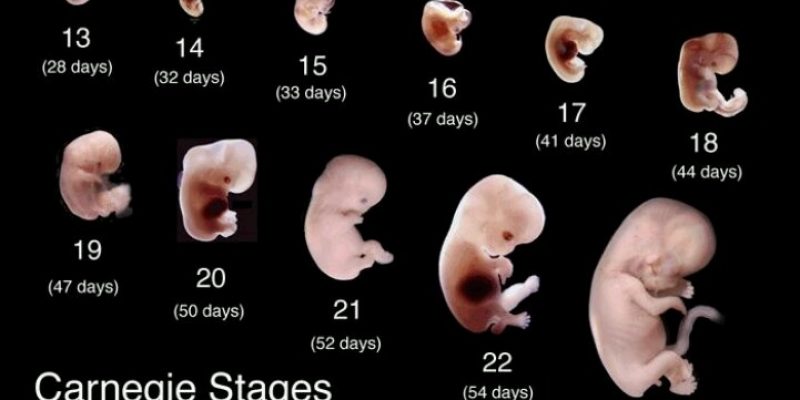 Is a fetus an elephant? A clump of cells? Just nothing and not human? [video]