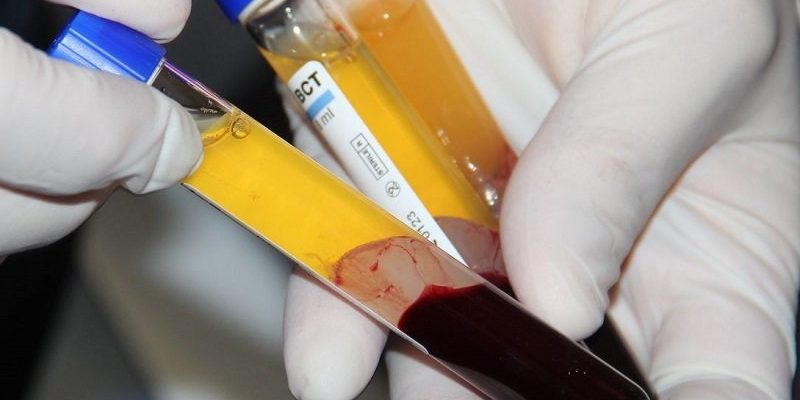 Want to feel younger? You can buy blood plasma for $8k in Tampa, Houston [videos]