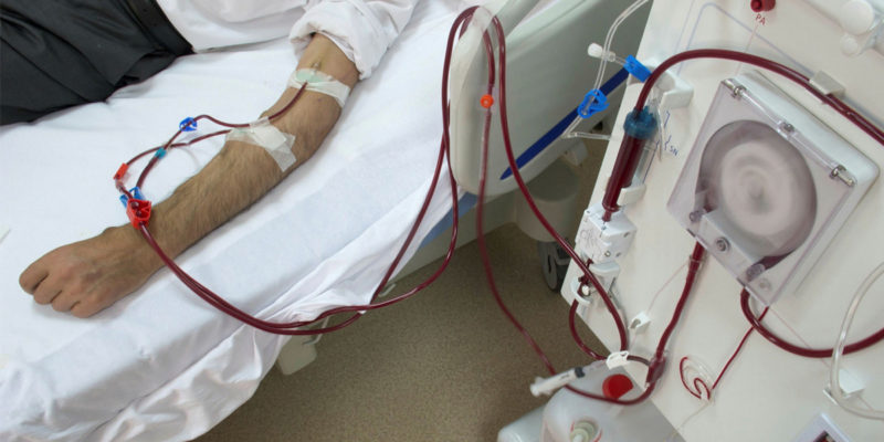 new-tool-assisting-dialysis-patients-to-protect-against-common-av